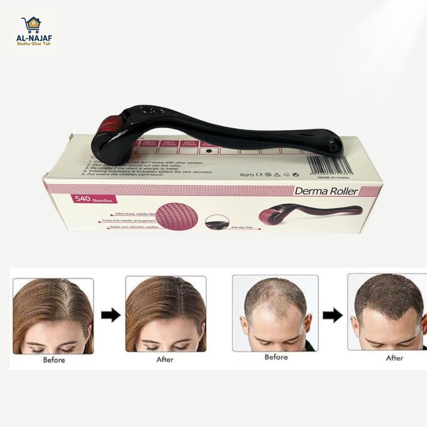 Professional Derma Roller – Skin Glow & Hair Regrowth Tool